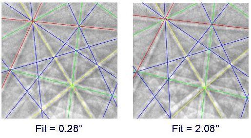 Image Quality (IQ): Er summen av detekterte topper i Hough-rommet. Enhver variabel som påvirker prosedyren fram til Hough transformasjonen vil derfor innvirke på IQ-verdien.