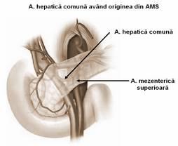 supraduodenal și cel retroduodenal și intrapancreatic peritoneul care trece de pe faţa anterioară a duodenului pe peretele abdominal posterior ligamentul Treitz, care suspendă unghiul duodeno-jejunal