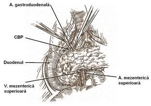 deasupra şi dedesubtul pancreasului se stabileşte un tunel Ñnapoia colului pancreasului (limitat anterior de colul pancreatic şi