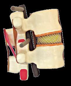 Mellomskiver/diskus Virker som en støtdemper i ryggen samt gjør ryggraden fleksibel.