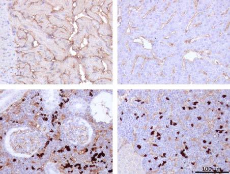 ILAV tropisme ILAV binder spesifikke reseptorer (4-O-acetylerte sialinsyrer) på cellenes overflate Nøkkel i lås Nødvendig, men ikke tilstrekkelig Forekomst av reseptor bestemmer tropisme Endotel