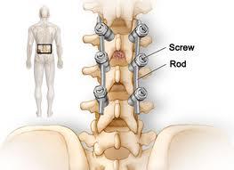 Ved Kysthospitalet gjøres disse operasjonene o est i nedre del av ryggen