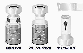 ThinPrep Pap Test prepareringsprosess SurePath ThinPrep Celleblanding: Spinning av cellemateriale blander celleprøven og løser opp blod, slim og debris Celleinnsamling: Væsken suges opp gjennom