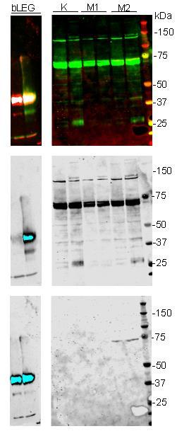 M P -L 0 1 (1 µ M ) - + - + - + - + - + Figur 4.6.: Inkubering av M1- og M2-lysater med aktivitetsbasert probe.