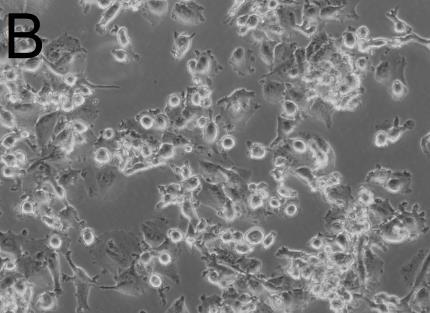 I M1-differensierte makrofager ble ikke uttrykket av moden legumain (36 kda) endret etter behandling med 0-5 μm atorvastatin, mens