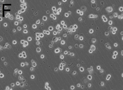 Housekeeping kontrollen (GAPDH) viste jevn proteinmengde i M1- og M2-makrofager behandlet med 0-25 μm atorvastatin, mens det var