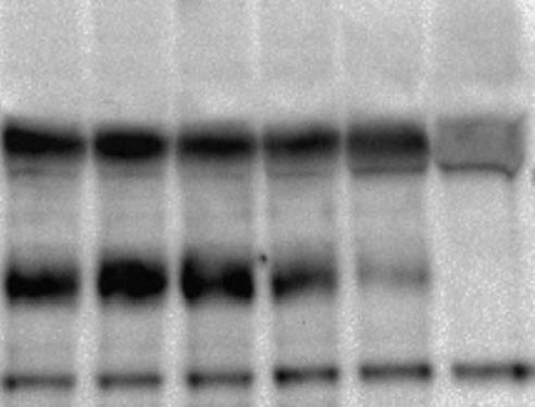 Under differensieringen ble THP-1 cellene behandlet med atorvastatin (A;0-50 μm).