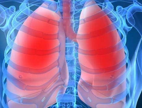 uttrekk: Avdelingen med flest lungebetennelser 30 enavdelingsopphold
