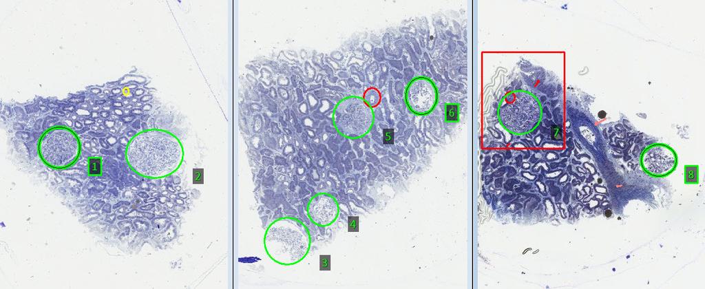 9 Samarbeid i forskningsprosjekter Podocytt inklusjoner toluidinblått farget semitynnsnitt glomerulus 1 2 3 4 5 6 7