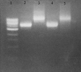RESULTATER 4.3 Kloning 4.3.1 PCR Under vises noen eksempler på hvordan resultatet etter en agarosegel kan bli. Gelene er laget som forklart i avsnitt 3.2.3 og tilsatt EtBr.