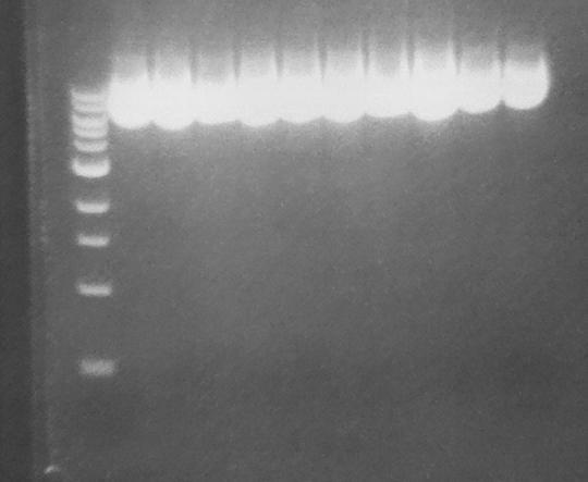 RESULTATER 4.3.2 Dyrkning av transformanter Etter PCR-reaksjonen ble plasmidene transformert inn i XL1-Blue Superkompetente celler.