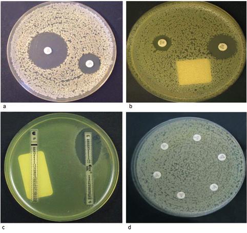 Tema Antibiotika resistens med andre antibiotika (6). Slike stammer ble påvist blant de første norske kliniske metallobetalaktamaseproduserende P aeruginosa-isolatene (7 9).