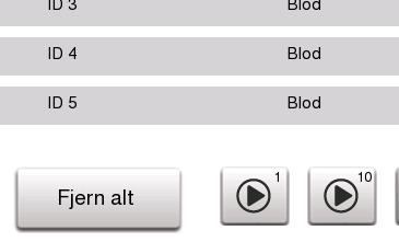 3. Bruk (prøveanalyse) Analyse av prøve (autolaster) 5 Start prøveenhet z Verifiser at korrekt hjulnummer er valgt. Ikke rør prøvehjul eller prøver under drift.