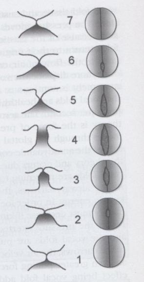 Figur 2 Illustrasjon av stemmebåndsvibrasjon (Sapienza & Hoffman-Ruddy, 2009, s. 75).