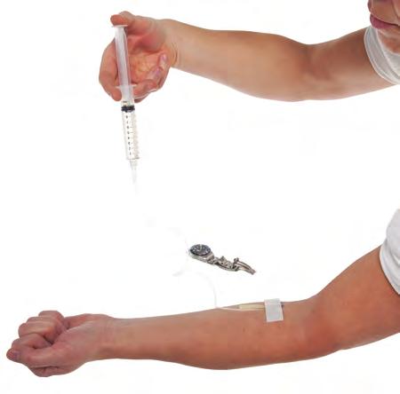 Hold armen rett og i ro under infusjonen. Din behandling vil ikke påvirkes av at en liten mengde legemiddel er igjen i venepunktursettet på slutten av injeksjonen.