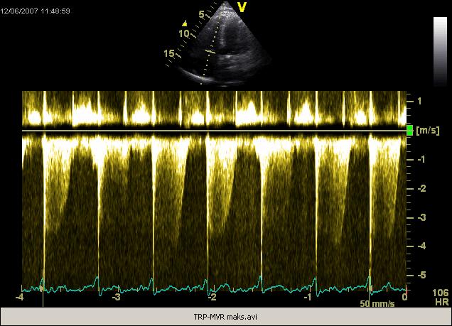 60 mmhg Helge Skulstad,