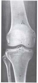 Oko poprečne osovine koja prolazi kroz kondile butne kosti: Fleksija Ekstenzija Obim 140 150