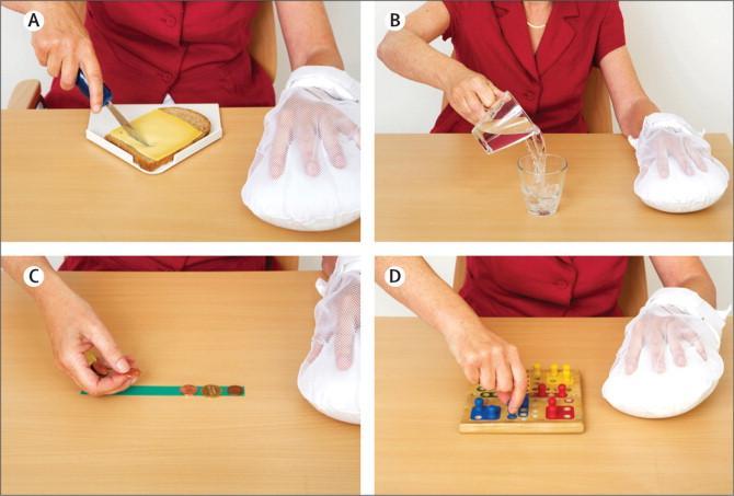 CIMT hos pasienter med gjennomgått hjerneslag PICO: Hva er effekten av Constraint-induced movement therapy (CIMT) i tidlig og sen fase (> 3 mnd) hos