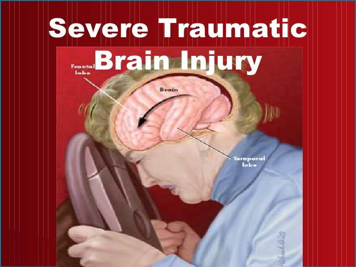 1. Hva er en alvorlig traumatisk hjerneskade? Et plutselig traume mot hodet som medfører en hjerneskade.