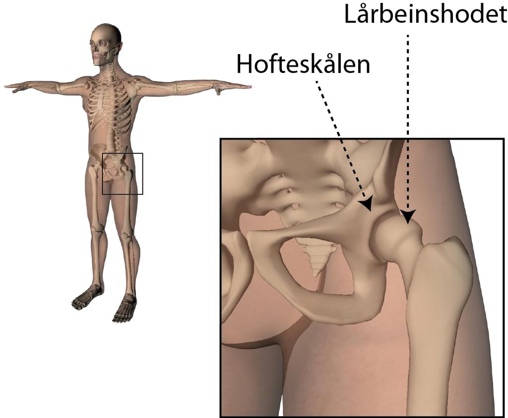 Figur 1. Hofteleddet nettverk av beinbjelker (trabekler) som letter absorpsjonen og distribusjonen av vektbelastningen på det tykke ytre (kortikale) beinet av lårhalsen og lårbeinsskaftet.