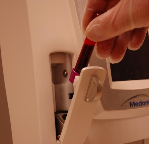 5.8 Analyse av prøven (lokkperforeringsenhet) Beskrivelse Dette avsnittet beskriver hvordan du analyserer fullblodsprøver ved hjelp av lokkperforeringsenheten.