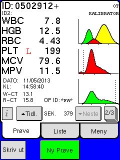 WBC-histogram HGB-parametere RBC-histogram Totalt RBC-tall og RBC-parametere PLT-histogram PLT-tall og PLT-parametere Figur 5.