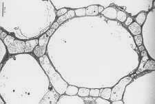 symbiose, og består av en soppdel og en algedel (og en sjelden gang også en cyanobakterie-del). Lav har en viktig økologisk nisje i mange økosystem, f.eks.