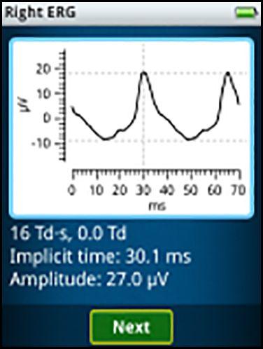 Bruksanvisning Testresultater 29 To perioder i den elektriske responsen, målt fra sensorkabelen til 32 Td s (venstre) og 16 Td s (høyre) hvit flimringsstimulus, vises.