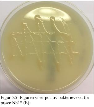 Resultatet fra prøve Nb1* (E) (figur 5.5) viser positiv bakterievekst på ESBL selektiv skål (Oxoid Brilliance ESBL).
