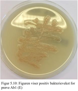 9) viser positiv bakterievekst på Karbapenemase selektiv skål (Oxoid Brilliance CRE).