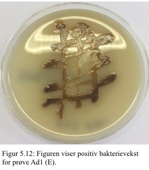 Resultatet fra prøve Ac1 (E) (figur 5.11) viser positiv bakterievekst på ESBL selektiv skål (Oxoid Brilliance ESBL).