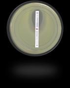 Gradienttest ESBL CARBA-B : imipenem + imipenem/edta: Ofte assosiert med falsk-positive/inkonklusive resultater Mellom/Latin Amerika
