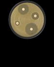 ESBL (ekstendert spektrum β-laktamase) ESBL A ESBL M ESBL M-C (pampc) β-laktamgruppe ESBL A ESBL M-C Penicilliner (Ampicillin, Piperacillin) 3. gen.