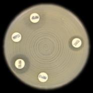 Temocillin (TMO) Algoritme: ESBL CARBA-A: