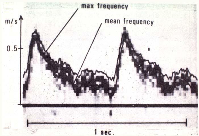 Frekvensspekter Hvert objekt sender sitt frekvenssignal tilbake.