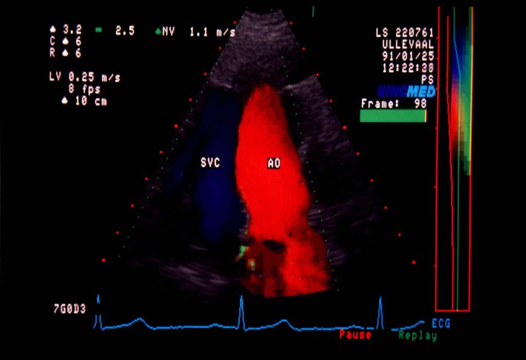 Anatomisk orientering ved