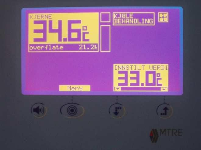 d c g h i Ønsket pasienttemperatur kan settes mellom 30-40 C med piltastene (a) og (b). Systemet forhåndsvelger 34 C.