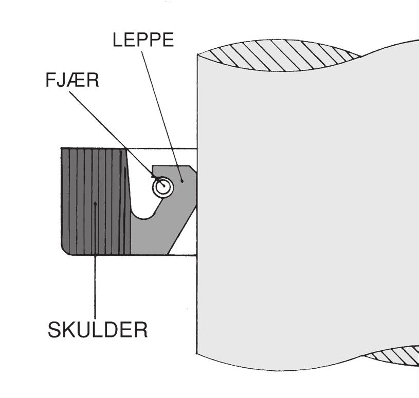 stålinnlegg.