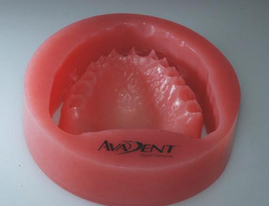 Fræsbare protesematerialer CAD/CAM-fremstilling af dentale restaureringer begyndte i 1980 erne, da Andersson introducerede sin Procera teknik (30).
