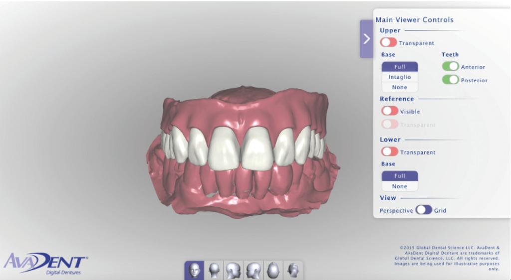 Figur 5. Digitalt protesedesign: Eksempel på digital tandopstilling for helproteser udført før udfræsning Foto: Murali Srinivasan, Genève, Schweiz.