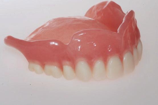 Det er enkelt at flytte en tand i opstillingen, da alle andre tænder justerer sig efter den ene tand, som er blevet flyttet.