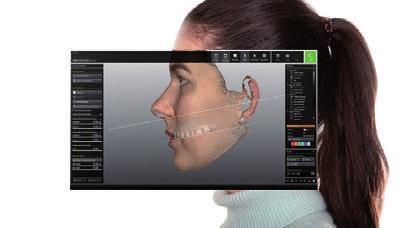 opplysninger med PlaneSystem, PlaneAnalyser og 3D-ansiktsskanneren Face Hunter økes planleggingssikkerheten, forkortes behandlingstiden og