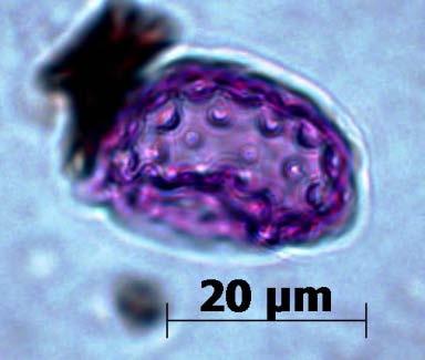 4.1.13 Sammenfatning Pollenprofilene gir generelt et bilde av et åpent landskap (< 15 % trepollen og 70-90 % urtepollen).