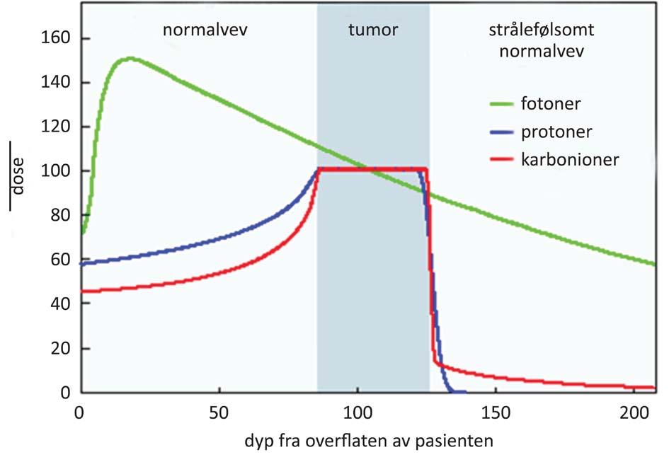 dosefordeling enn konvensjonell plan, og omtrent same dose i tumor som for protoner. Den store skilnaden er at dose i omkring liggande normalvev (farget på IMRT-planen) er mykje lågare i protonplanen.