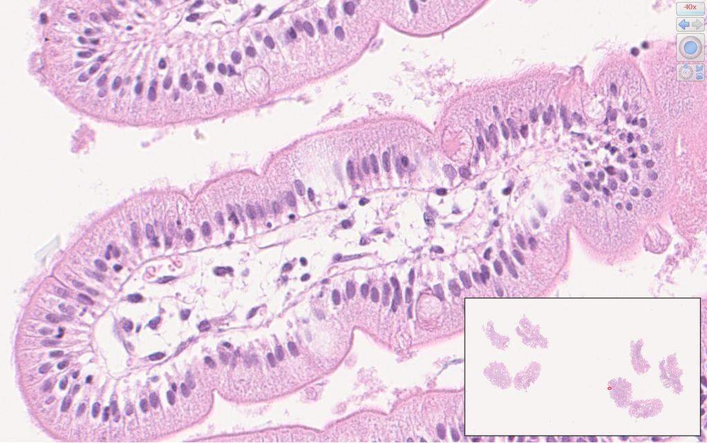 Faktaboks: Kort om formaldehyd som fiksativ for vevsprøver til histologi «Fiksering» er et avgjørende trinn i prosessen for å preparere vev for histologisk undersøkelse.