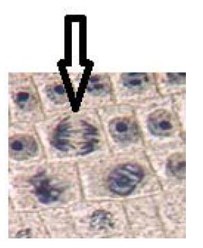 Genetikk 161 (oppgave 13 høst 2016) Figuren viser løkceller fra delingssonen i rota. I hvilken fase er cellen som pilen peker på?