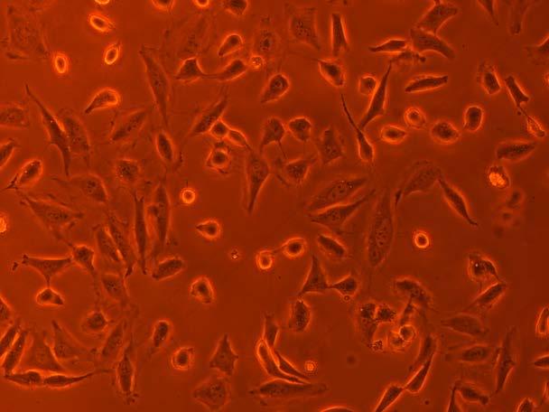 Materialer og metode ble fire 1,5 ml eppendorfrør tilsatt 4 µl plasmid (x ng), 1 µl NEBuffer 2 (eller EcoRI buffer), 4 µl dh 2 O og 1 µl restriksjonsenzym (1 5 U/µg DNA).