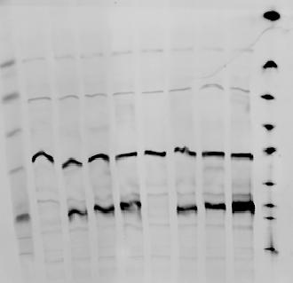 Resultater 1.3 Western blot viste at EGFP-FoxO3a, FoxO3a-EGFP og mcherry-foxo3a uttrykte proteiner.