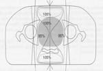 Valg av behandlingsmetode Individuell tilpasset behandling Optimal behandling ihht.