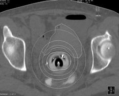 oesophagus ol.